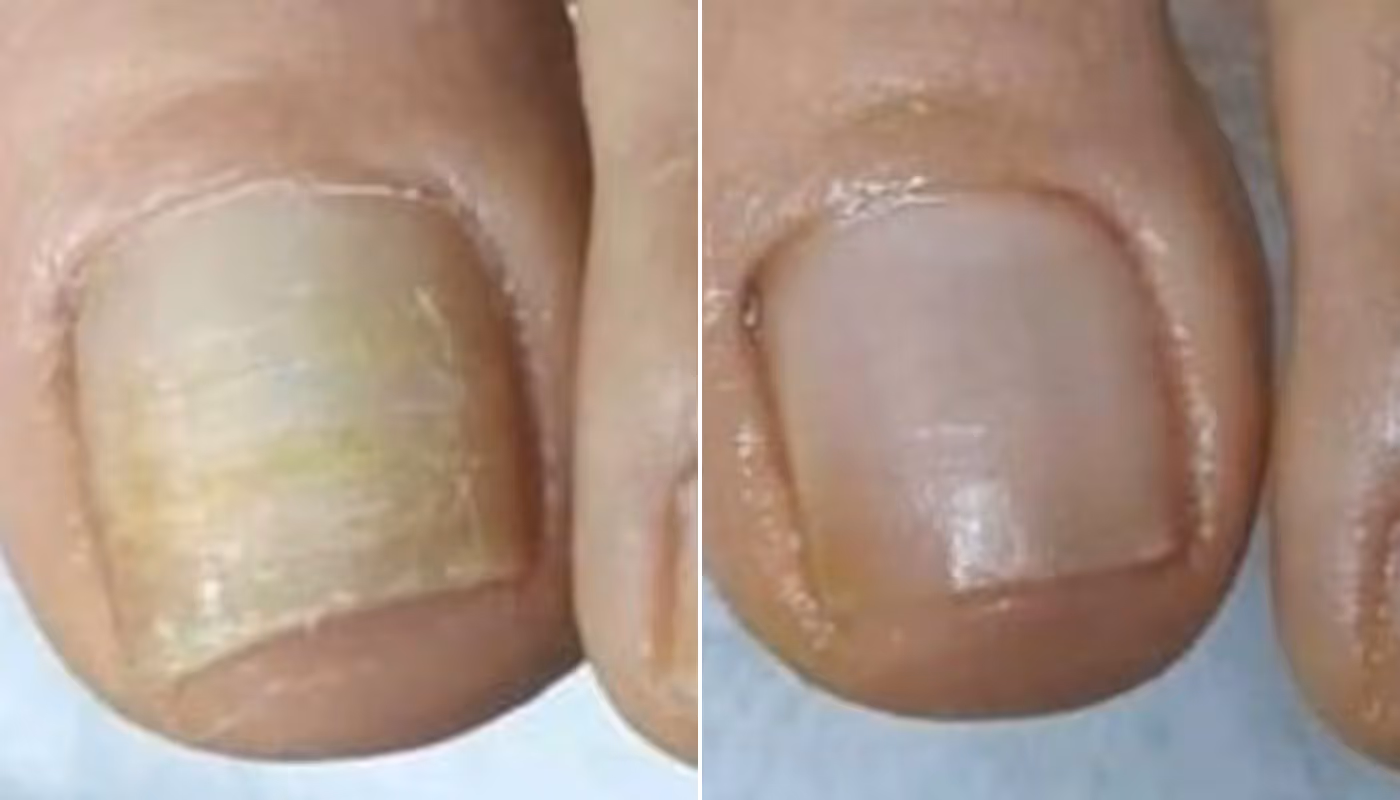 orville pen review by Linda